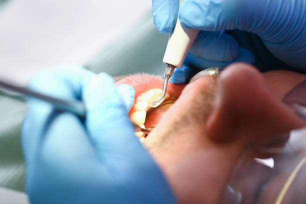 Best Emergency Dentist for Knocked-Out Tooth in Shpee Neck, MA