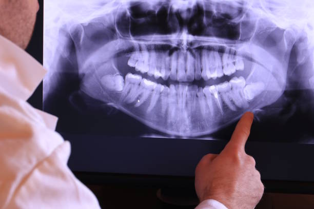 Best Emergency Dentist for Special Needs Patients in Shpee Neck, MA